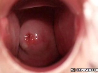 Şepagat uýasy zaneta serpikdirme masturbation at clinic